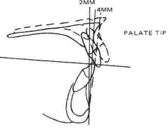 Manual Illustration